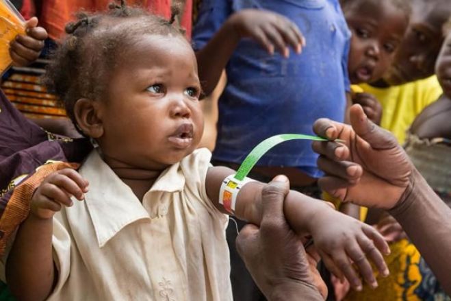 Metade das províncias angolanas enfrentam situação de extrema gravidade de desnutrição