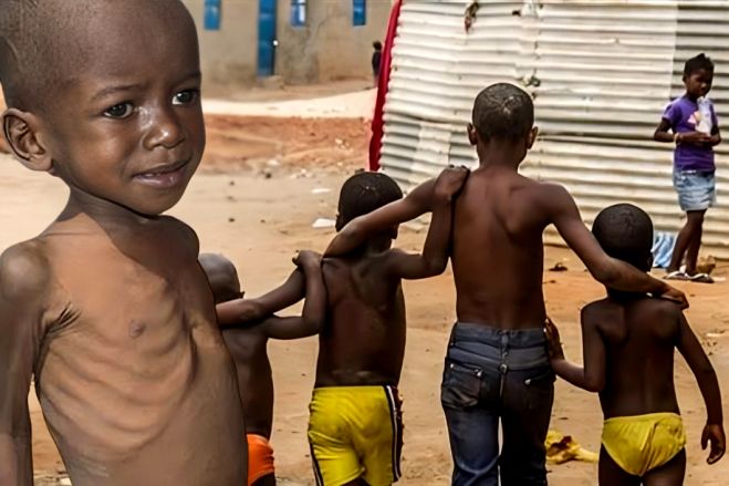 Fome &#039;persegue&#039; angolanos e situação tende a piorar