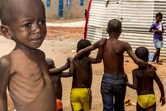 Fome &#039;persegue&#039; angolanos e situação tende a piorar