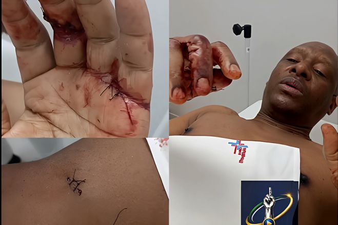 Norberto Garcia esfaqueado durante assalto em Luanda