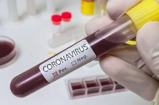 Covid-19: Angola regista mais dois casos e eleva para 10 o número de infetados