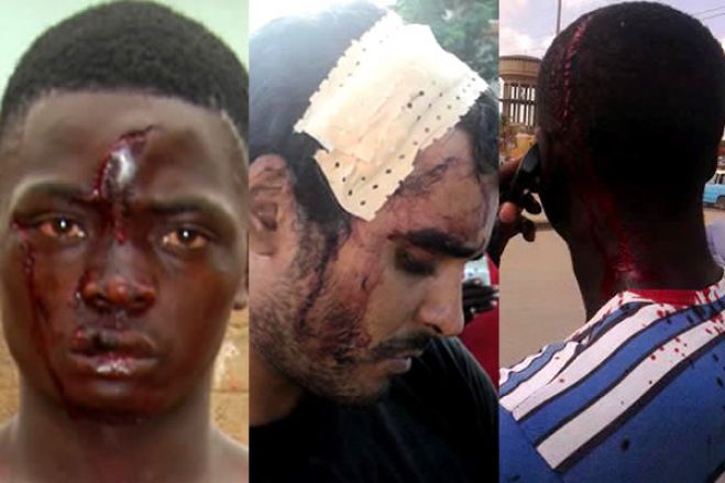 Ativistas dizem que direitos humanos continuam a ser violados, MPLA promete reforçar pilares da democracia